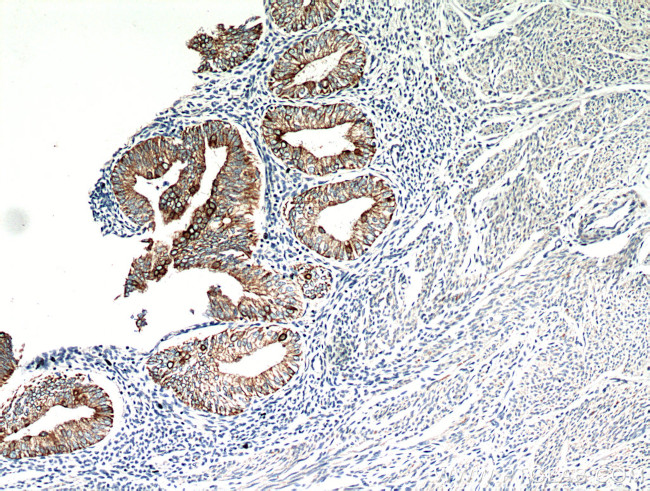 Cytokeratin 18 Antibody in Immunohistochemistry (Paraffin) (IHC (P))