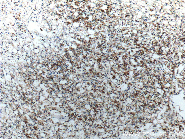 Cytokeratin 18 Antibody in Immunohistochemistry (Paraffin) (IHC (P))