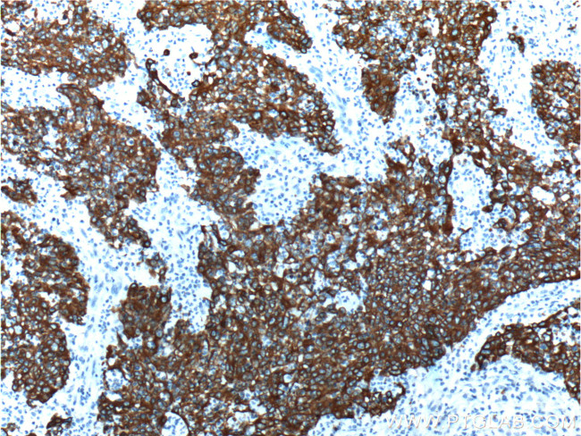 Cytokeratin 18 Antibody in Immunohistochemistry (Paraffin) (IHC (P))