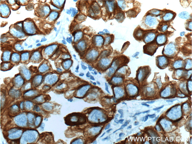 Cytokeratin 18 Antibody in Immunohistochemistry (Paraffin) (IHC (P))