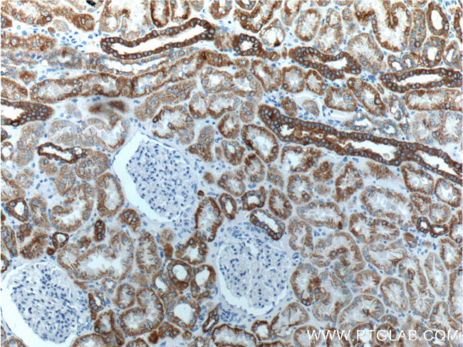 Cytokeratin 18 Antibody in Immunohistochemistry (Paraffin) (IHC (P))