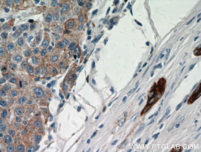 Cytokeratin 18 Antibody in Immunohistochemistry (Paraffin) (IHC (P))