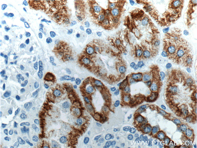 Cytokeratin 18 Antibody in Immunohistochemistry (Paraffin) (IHC (P))