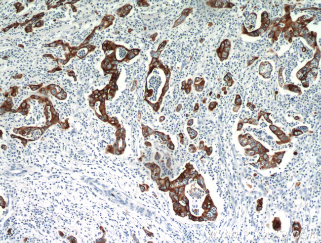 Cytokeratin 18 Antibody in Immunohistochemistry (Paraffin) (IHC (P))