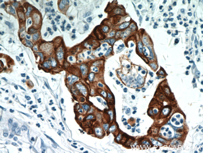 Cytokeratin 18 Antibody in Immunohistochemistry (Paraffin) (IHC (P))