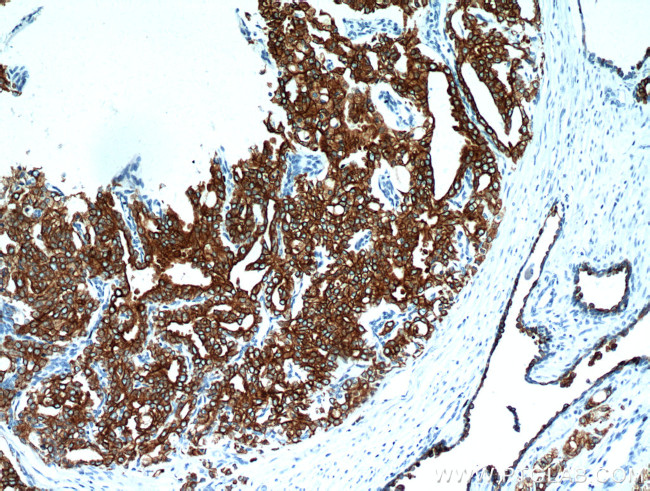 Cytokeratin 18 Antibody in Immunohistochemistry (Paraffin) (IHC (P))