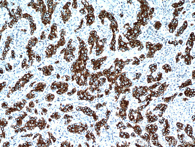 Cytokeratin 18 Antibody in Immunohistochemistry (Paraffin) (IHC (P))