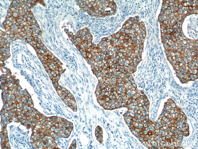 Cytokeratin 18 Antibody in Immunohistochemistry (Paraffin) (IHC (P))