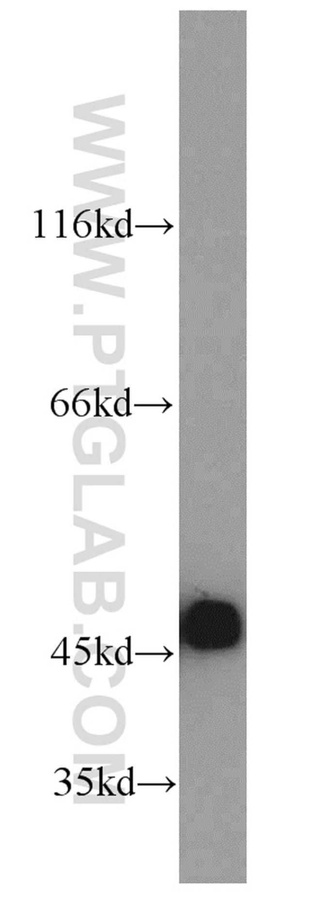 Cytokeratin 18 Antibody in Western Blot (WB)