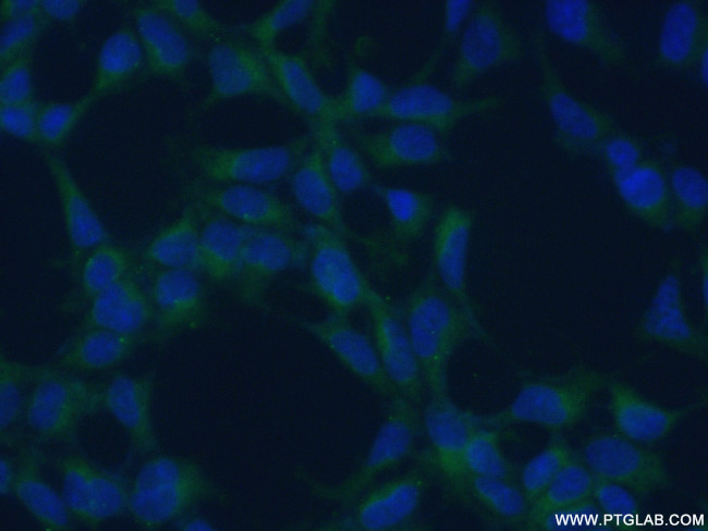 EPHX2 Antibody in Immunocytochemistry (ICC/IF)