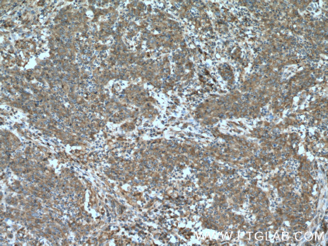 EPHX2 Antibody in Immunohistochemistry (Paraffin) (IHC (P))