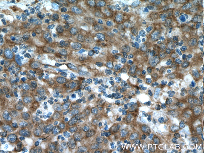 EPHX2 Antibody in Immunohistochemistry (Paraffin) (IHC (P))