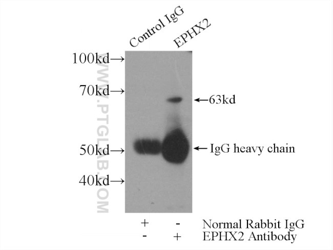 EPHX2 Antibody in Immunoprecipitation (IP)