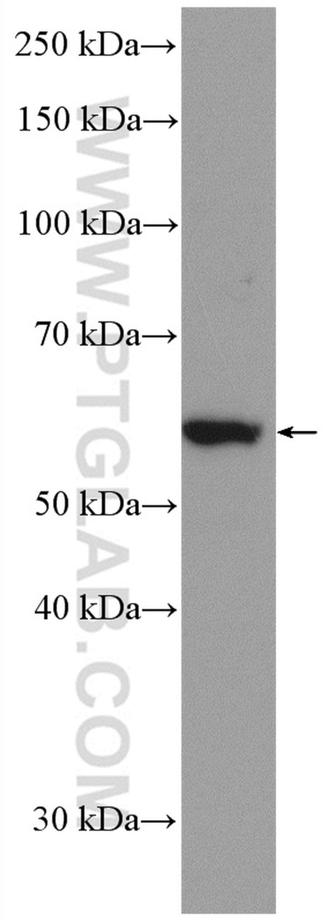 EPHX2 Antibody in Western Blot (WB)