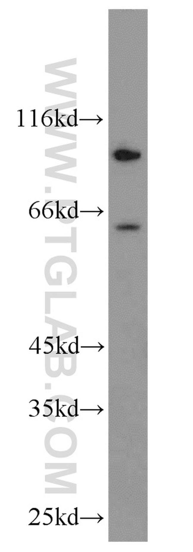 EPHX2 Antibody in Western Blot (WB)