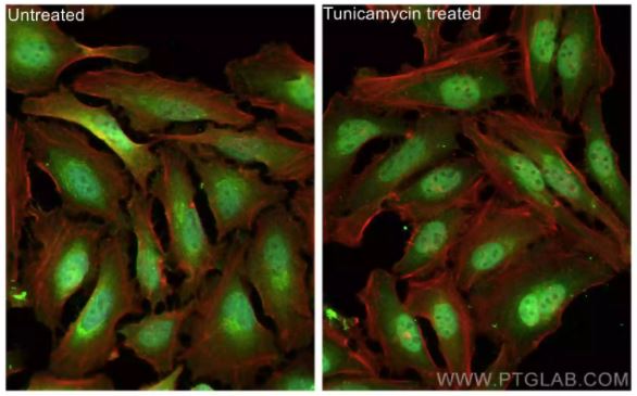 ATF4 Antibody in Immunocytochemistry (ICC/IF)