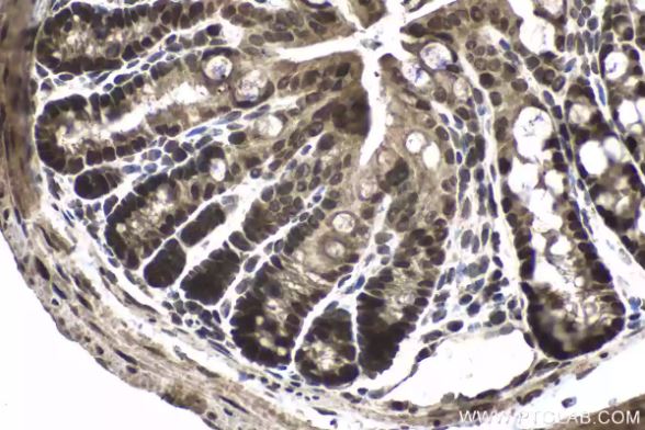 ATF4 Antibody in Immunohistochemistry (Paraffin) (IHC (P))