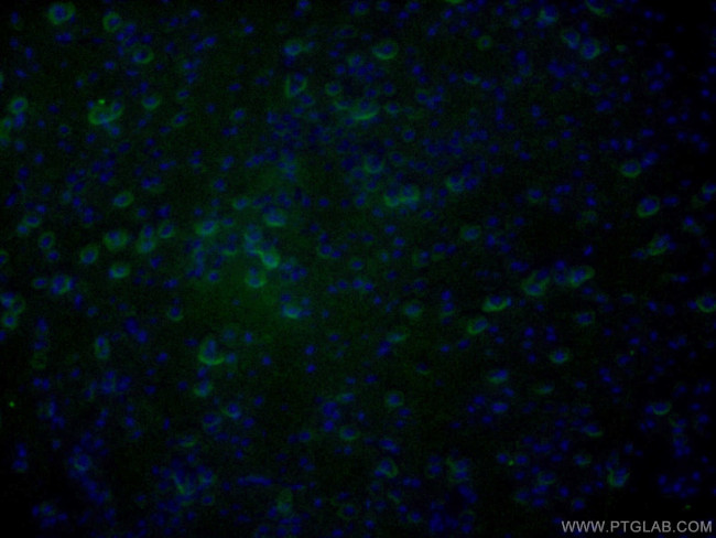 alpha-synuclein Antibody in Immunohistochemistry (PFA fixed) (IHC (PFA))