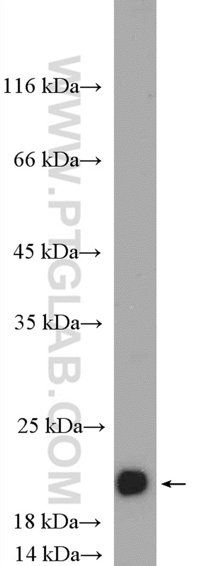 alpha-synuclein Antibody in Western Blot (WB)