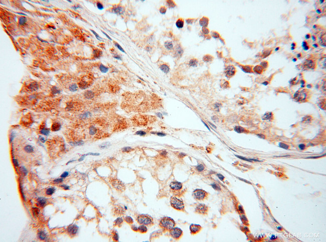 alpha-synuclein Antibody in Immunohistochemistry (Paraffin) (IHC (P))