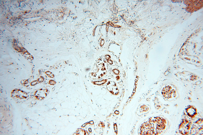 alpha-synuclein Antibody in Immunohistochemistry (Paraffin) (IHC (P))