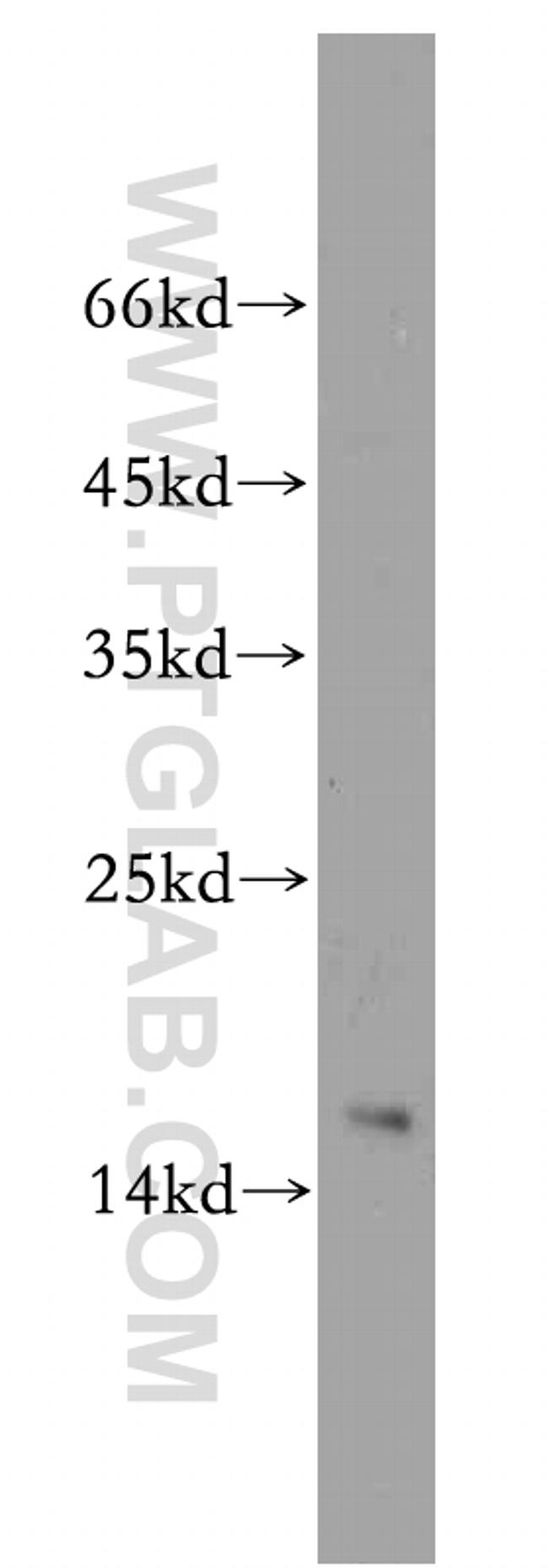 alpha-synuclein Antibody in Western Blot (WB)