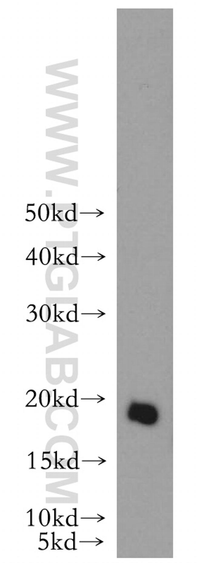 alpha-synuclein Antibody in Western Blot (WB)