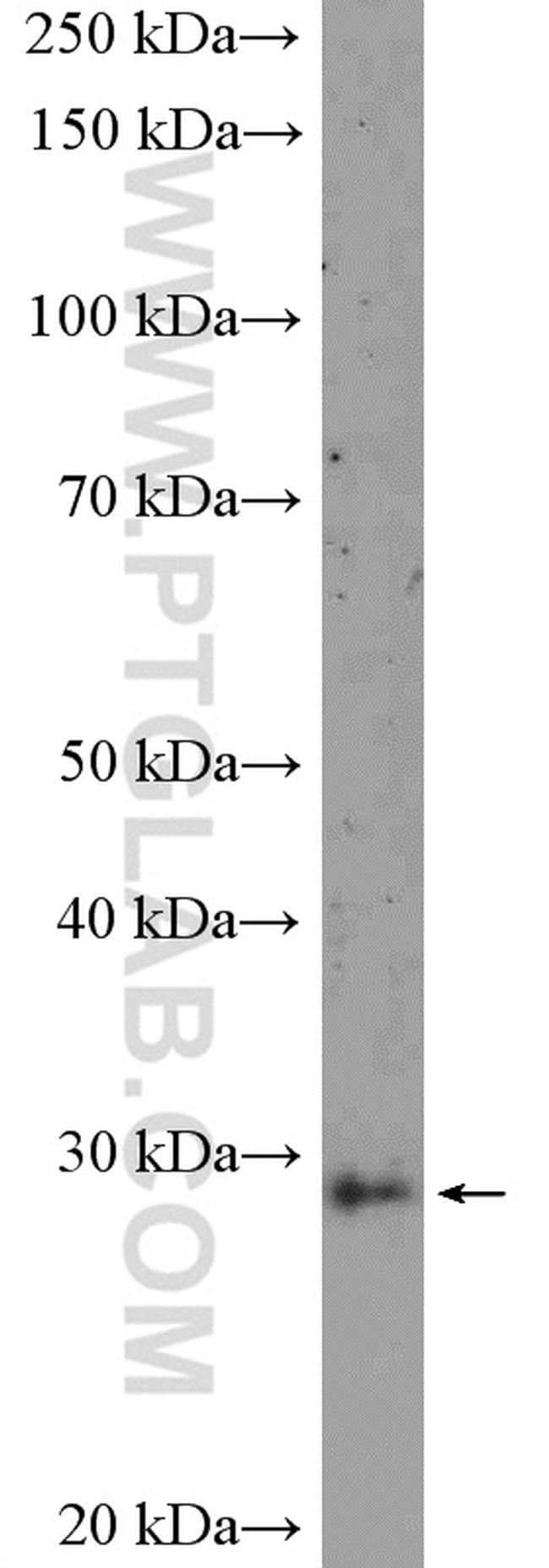 ANP32B Antibody in Western Blot (WB)