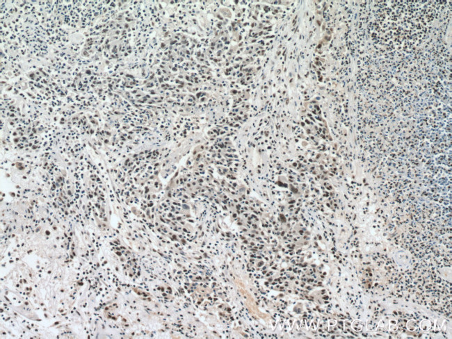 ANP32B Antibody in Immunohistochemistry (Paraffin) (IHC (P))