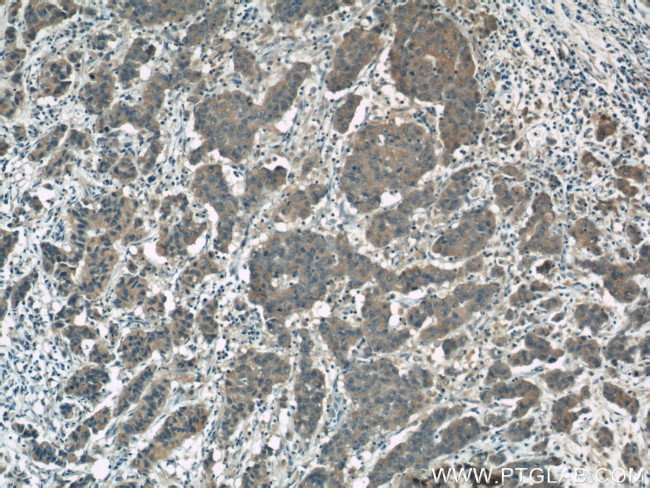 FOXO3A Antibody in Immunohistochemistry (Paraffin) (IHC (P))