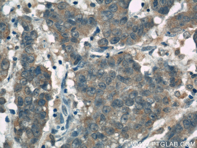 FOXO3A Antibody in Immunohistochemistry (Paraffin) (IHC (P))