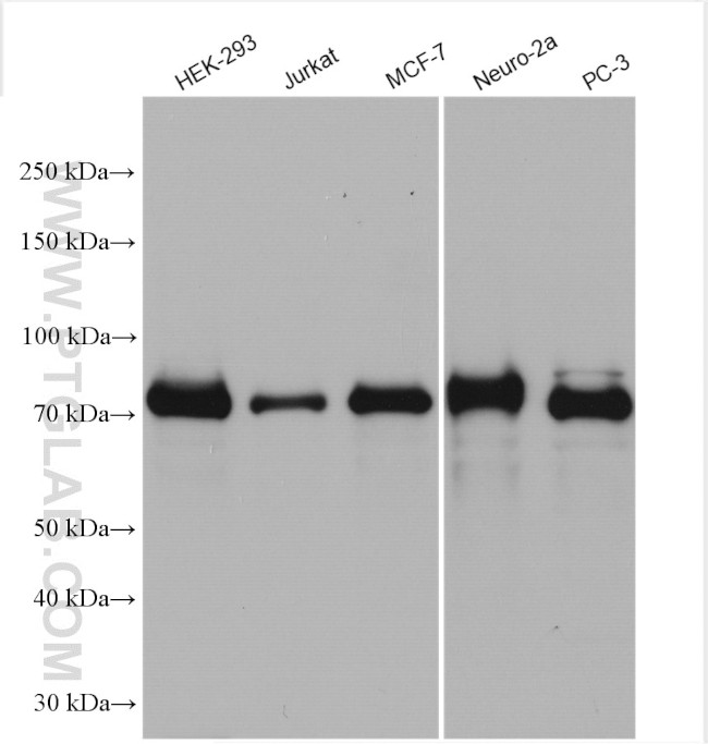 FOXO3A Antibody in Western Blot (WB)