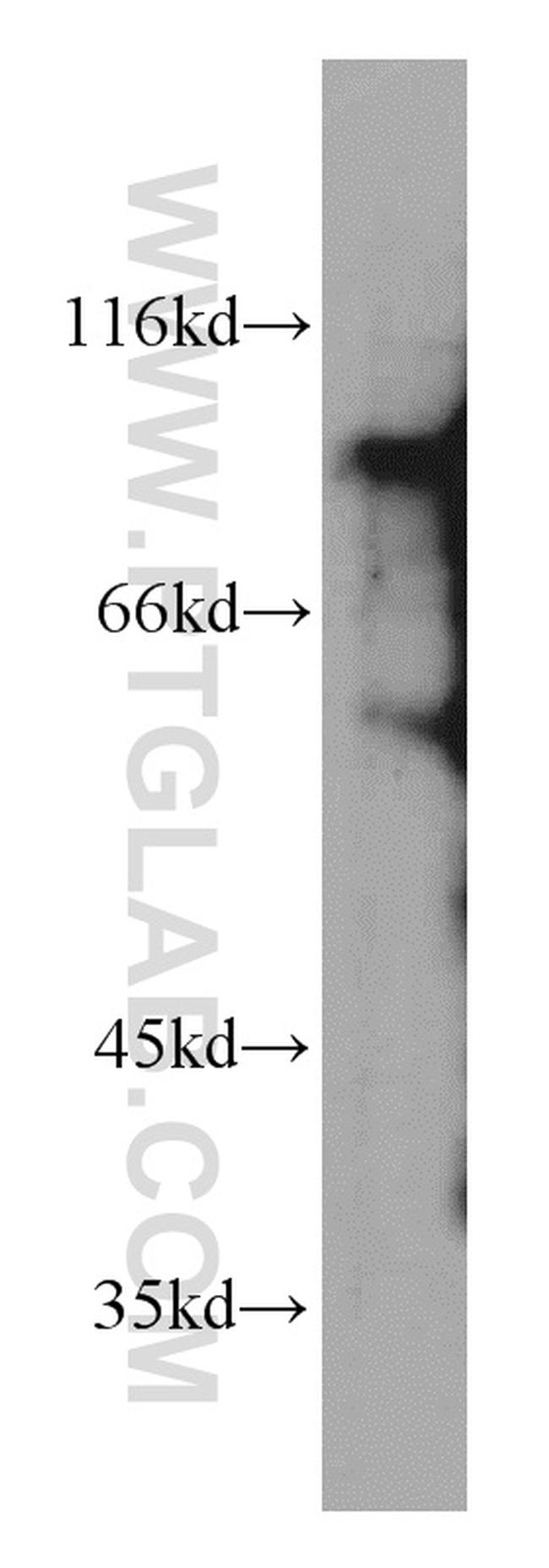 FOXO3A Antibody in Western Blot (WB)