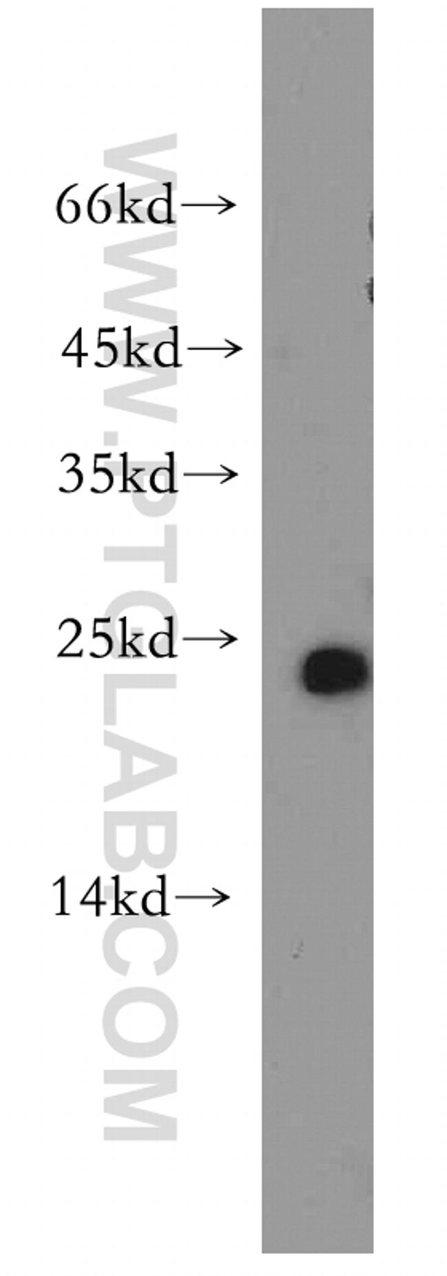 GLTP Antibody in Western Blot (WB)