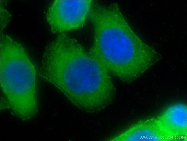 Palladin Antibody in Immunocytochemistry (ICC/IF)