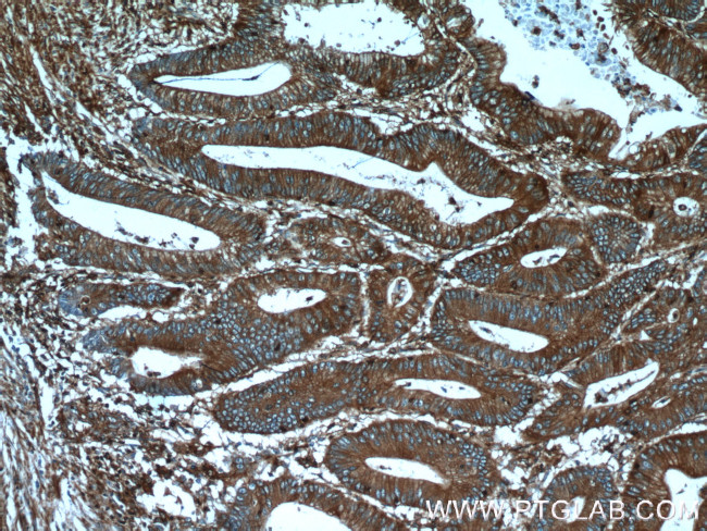 Palladin Antibody in Immunohistochemistry (Paraffin) (IHC (P))