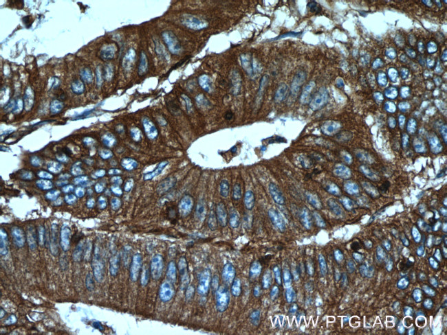 Palladin Antibody in Immunohistochemistry (Paraffin) (IHC (P))