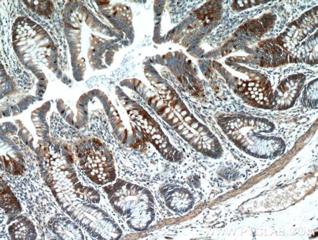 Palladin Antibody in Immunohistochemistry (Paraffin) (IHC (P))