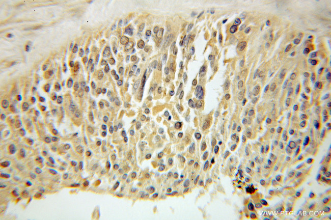 Palladin Antibody in Immunohistochemistry (Paraffin) (IHC (P))