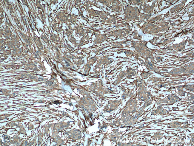 Palladin Antibody in Immunohistochemistry (Paraffin) (IHC (P))