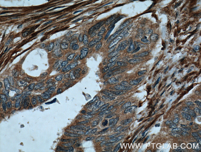 Palladin Antibody in Immunohistochemistry (Paraffin) (IHC (P))