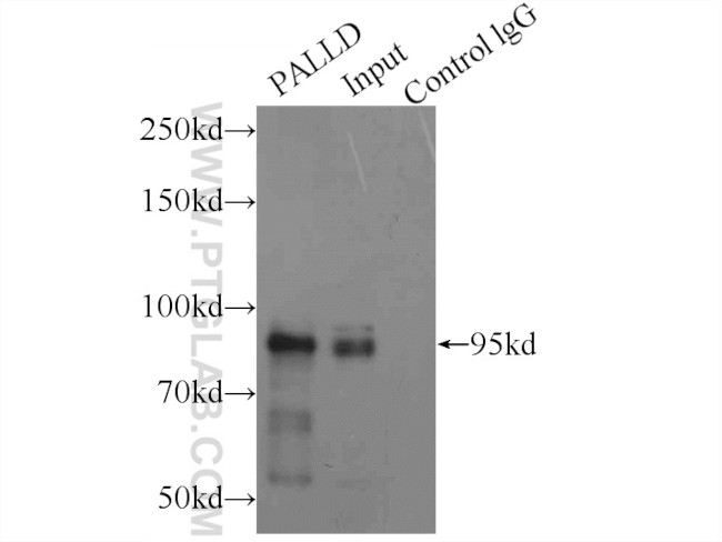 Palladin Antibody in Immunoprecipitation (IP)