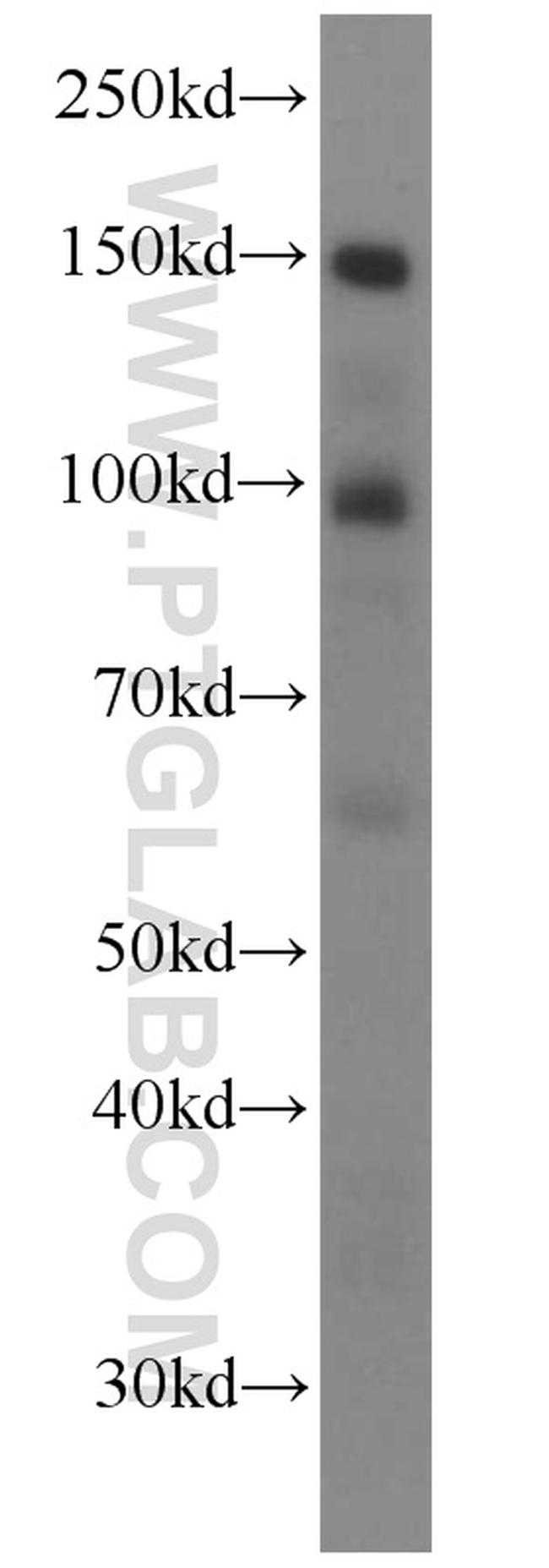 Palladin Antibody in Western Blot (WB)