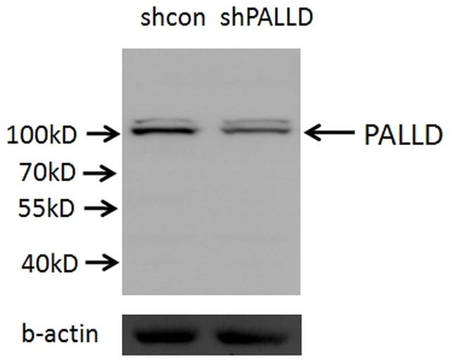 Palladin Antibody in Western Blot (WB)