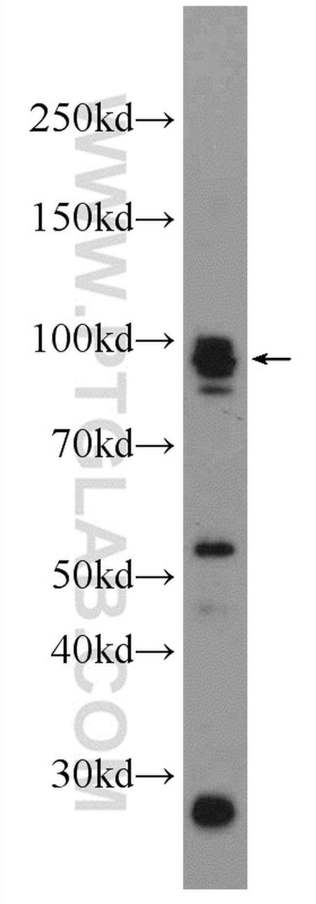 Palladin Antibody in Western Blot (WB)