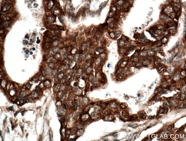 BLNK Antibody in Immunohistochemistry (Paraffin) (IHC (P))