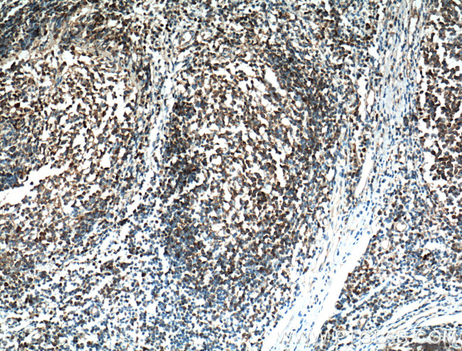 BLNK Antibody in Immunohistochemistry (Paraffin) (IHC (P))