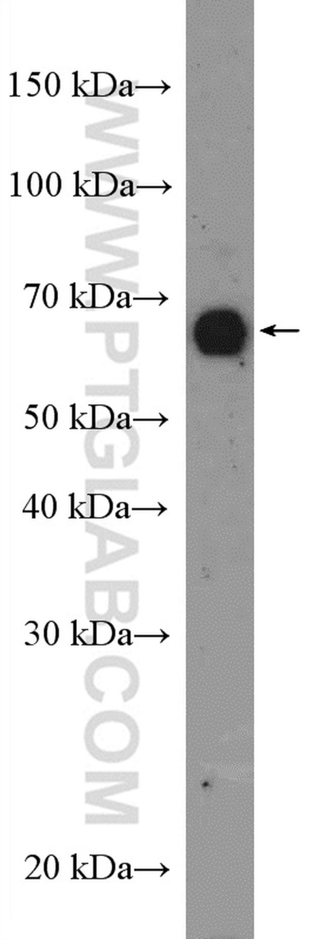 BLNK Antibody in Western Blot (WB)