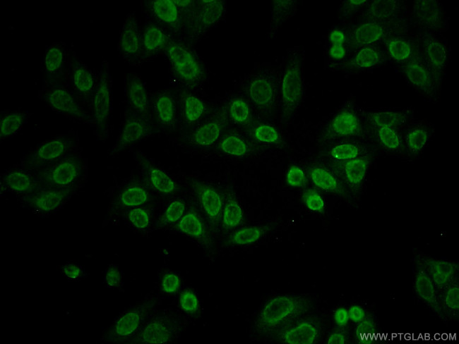 MECP2 Antibody in Immunocytochemistry (ICC/IF)