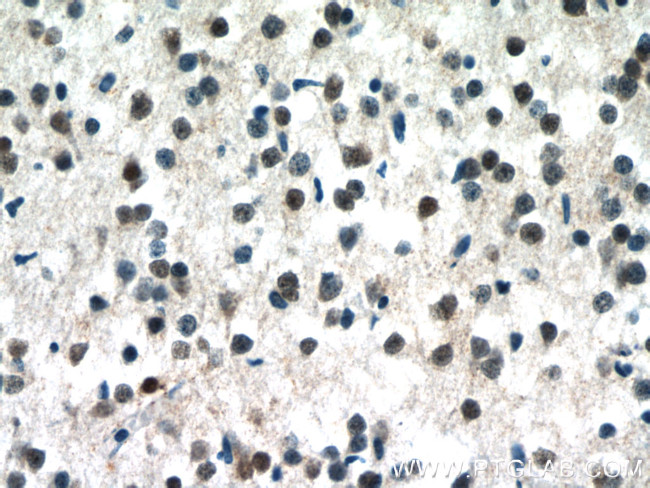 MECP2 Antibody in Immunohistochemistry (Paraffin) (IHC (P))